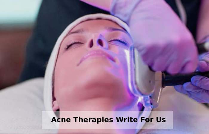 Acne Therapies Write For Us