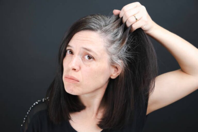 wellhealthorganic.com_know-the-causes-of-white-hair-and-easy-ways-to-prevent-it-naturally