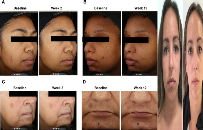 Benefits of Choosing a Derma Med Spa