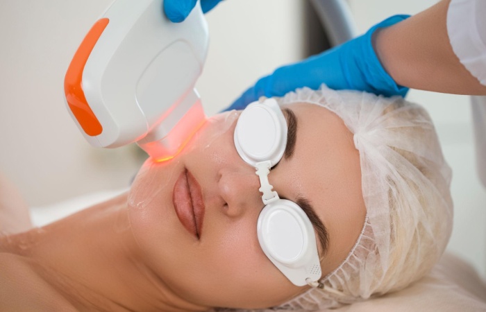 q switch laser pigmentation treatment indian skin